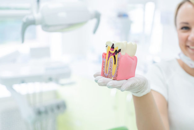 what is a root canal dentist uses model to demonstrate what is a root canal