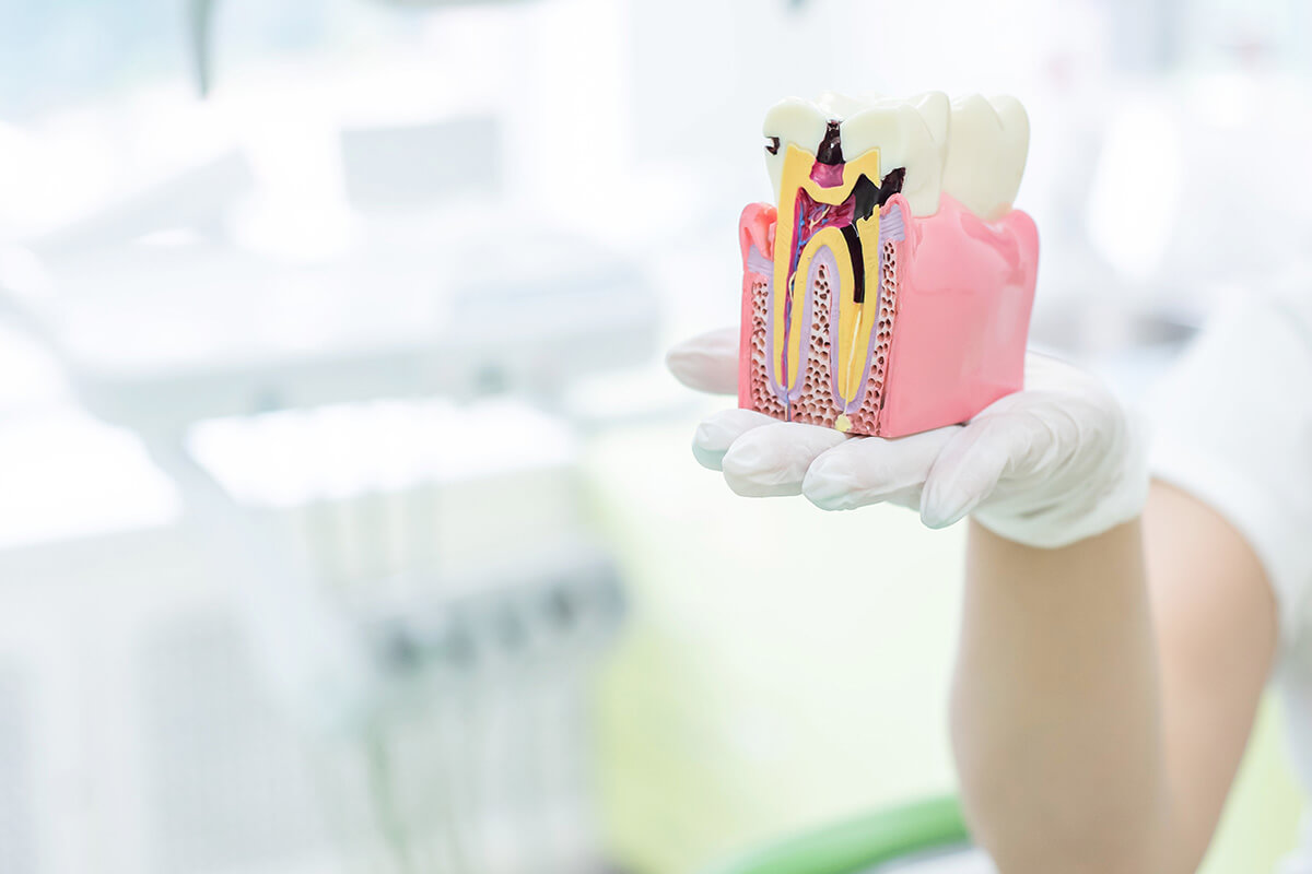 an endodontist offers a tooth shaped cake to celebrate root canal awareness week