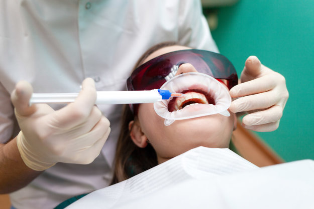 what is teeth whitening woman getting teeth whitening at the dentist