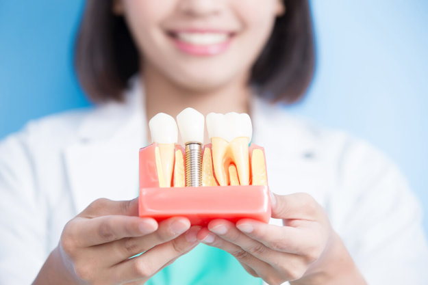 implant dentist implant dentist showing model of teeth implants