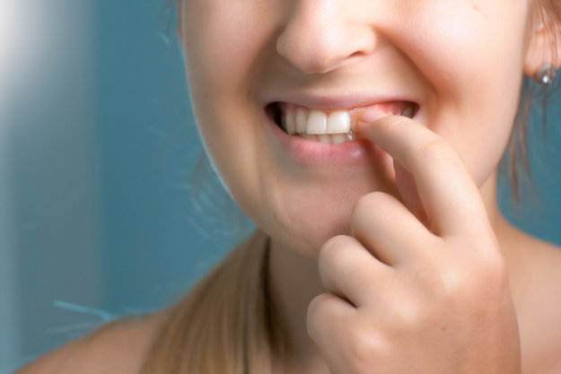 periodontal disease prevention woman pointing to her gums asking for periodontal disease prevention