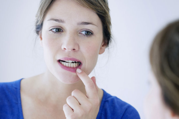 receding gums woman looking at receding gums