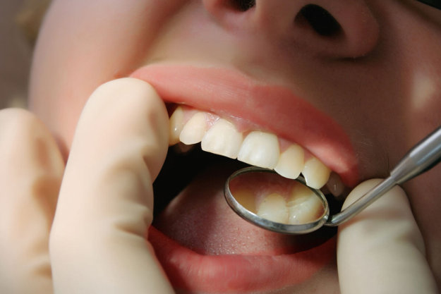 How do we Treat Gingivitis patient being examined learning what is gingivitis