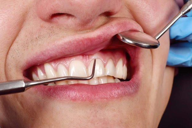 What are Common Periodontal Treatments periodontal treatment being done