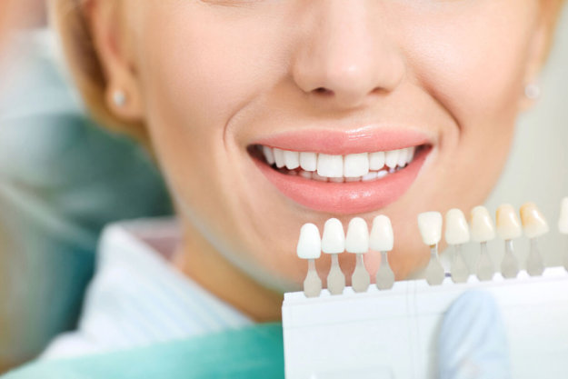 What do Veneers do veneers being held up to patient teeth