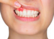 person experiencing gum inflammation
