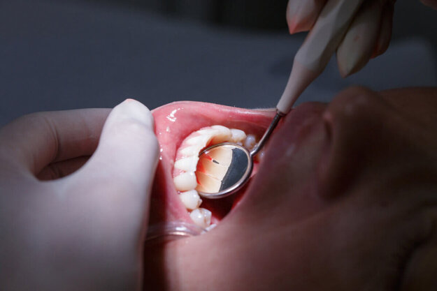 What Causes Receding Gums image symbolizing what causes receding gums