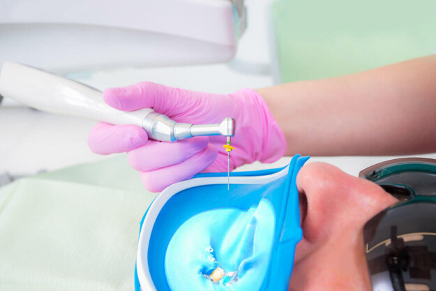 What Is the Recovery Time for a Root Canal_ dentist prepares a patient for root canal recovery