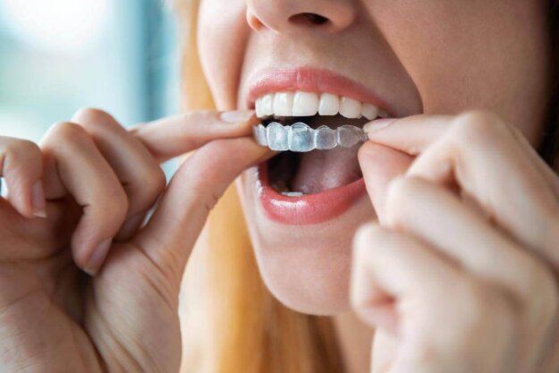 What is Invisalign_ woman puts in invisalign while learning what is invisalign