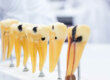 model teeth show where to find a root canal in columbia, md
