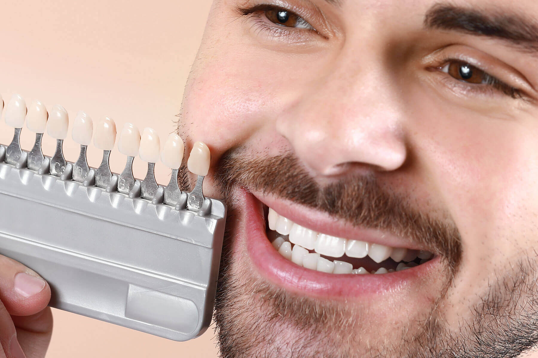 How Much Do Dental Veneers Cost A man thinking about dental veneer cost