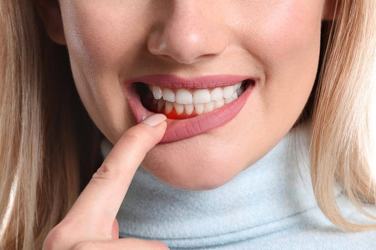 What Is Periodontal Disease A woman wondering, "What is periodontal disease?"