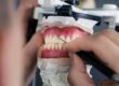 Image symbolizing full vs. partial dentures