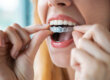 A woman starting Invisalign