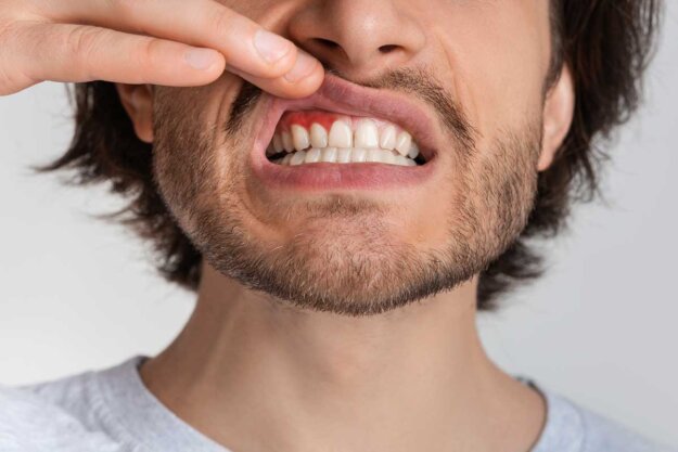 Does this man know how gum disease affects your health?