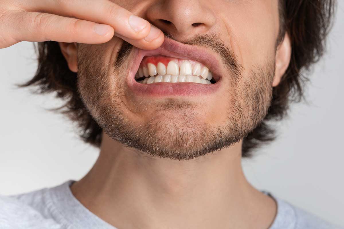 How Gum Disease Affects Your Health Does this man know how gum disease affects your health?