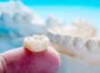 Dental crown close up